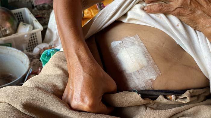 Ibu Titin (55) menjadi korban penusukan oleh T (18) di Kampung Cimanggu Kecil Gang Pasama RT 003 RW 007, Kelurahan Ciwaringin, Kecamatan Bogor Tengah, Kota Bogor, pada Rabu lalu.