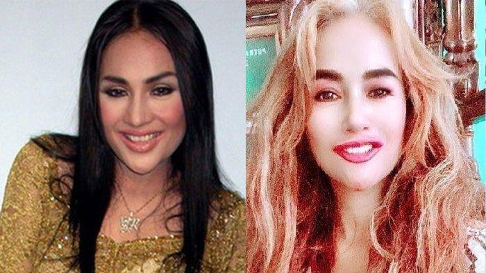 Penampilan terbaru Lilis Karlina, pedangdut yang diisukan sakit parah hingga tubuhnya tinggal kulit balut tulang. Lilis akhirnya ungkap kabar terbarunya di media sosial.