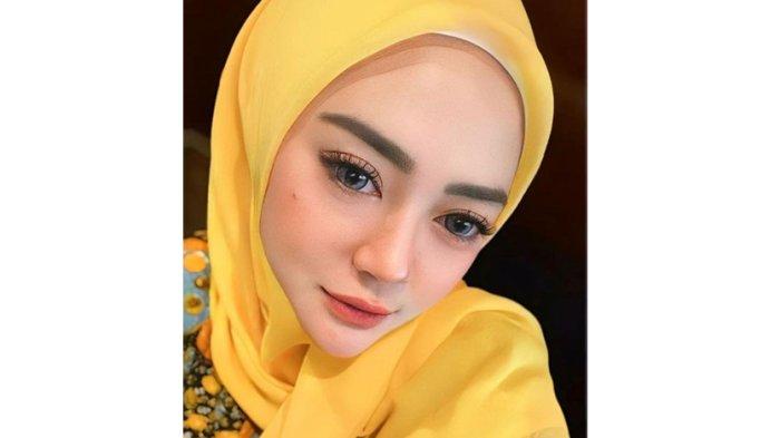 Noni Ayi, owner NBS Skincare menceritakan jatuh bangunnya membangun usaha sampai menjadi besar.