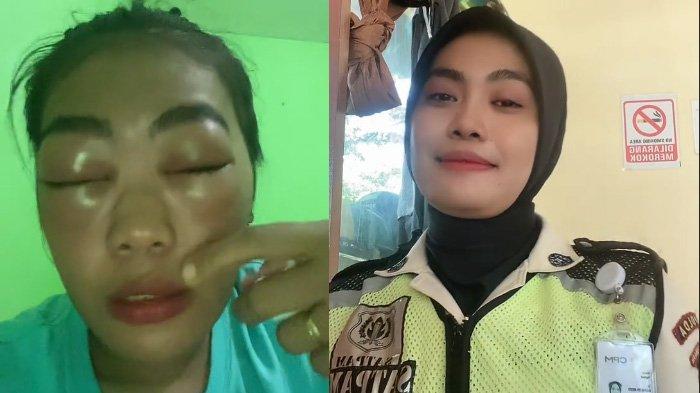 Viral curhatan seorang satpam cantik tiba-tiba matanya bengkak dan bibirnya jontor setelah minum obat. Satpam bernama Pratiwi itu akhirnya mengurai kondisi terbaru