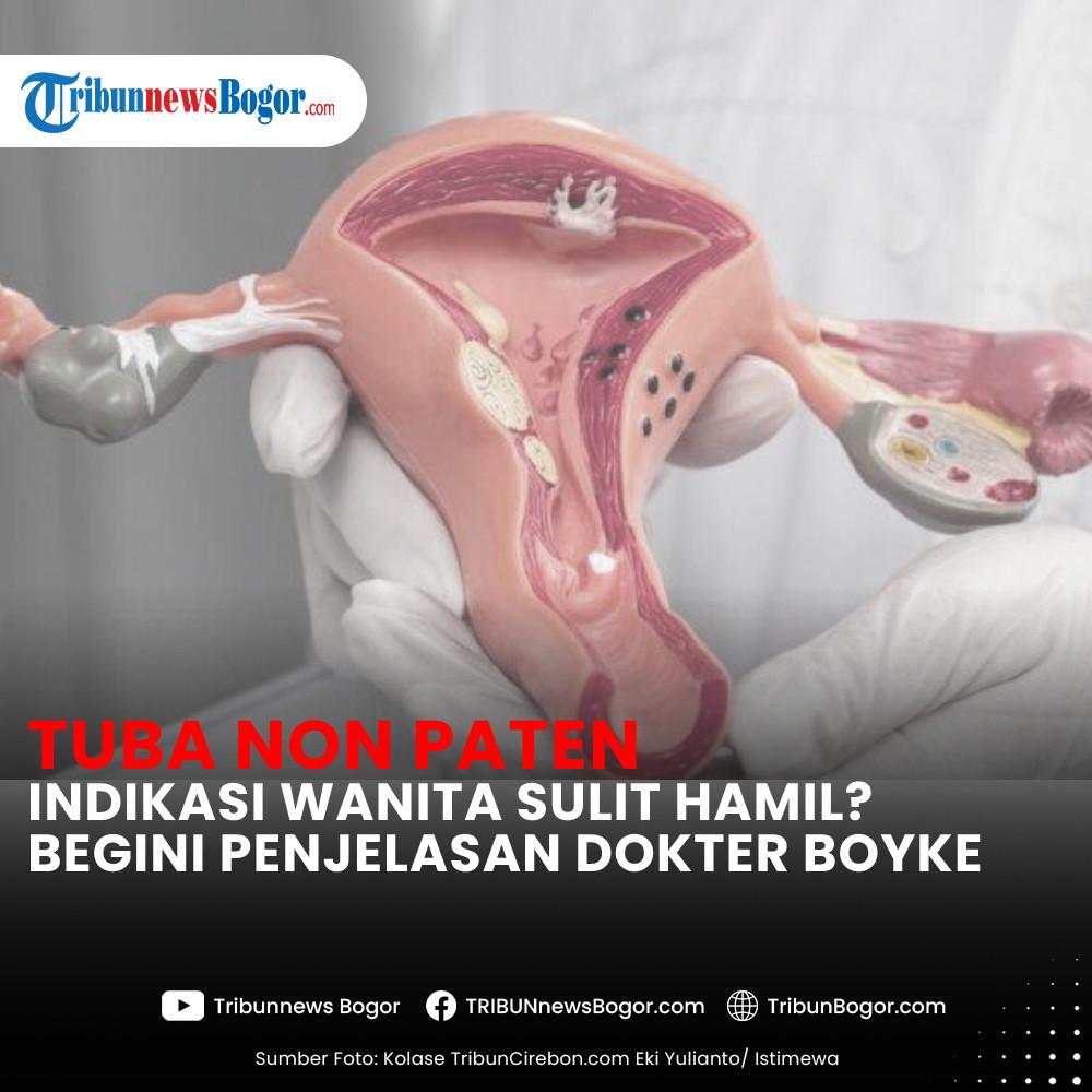 Dokter Boyke menjelaskan arti dari hasil tes HSG tuba non paten pada wanita yang sedang dalam program kehamilan. Benarkah jadi penyebab wanita sulit hamil?