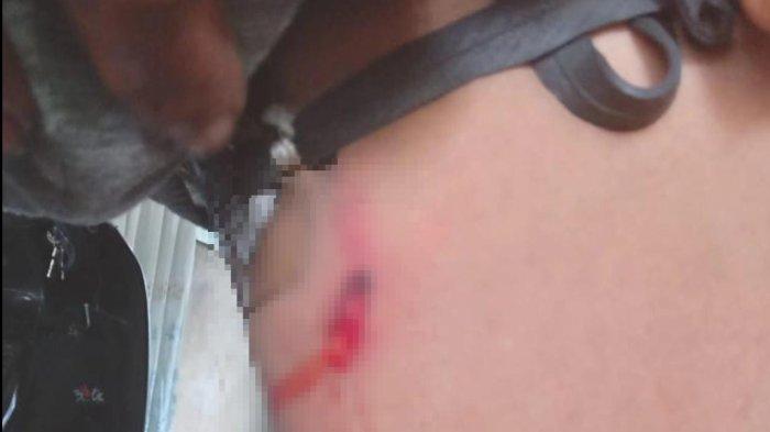 Tatang Rustana (30) warga Desa Cilembu, Kecamatan Pamulihan tertembak mimis dari senapan angin orang tak dikenal, Sabtu (1/7/2023) di Gunung Kareumbi, Sumedang