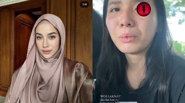 Selebgram Aghnia Punjabi alias Emy Aghnia (kiri) mengungkapkan bagaimana anaknya disiksa pengasuhnya, I (kanan)