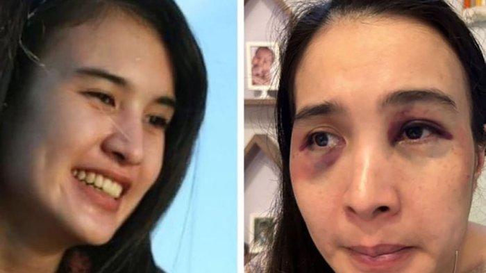 Unggahan di Twitter oleh Sahara Hanum mengungkapkan bahwa kakaknya menjadi korban KDRT oleh sang suami, namun justru menjadi tersangka dalam kasus ini.