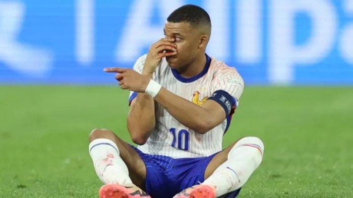 Kylian Mbappe mengalami cedera hidung saat melawan Austria.