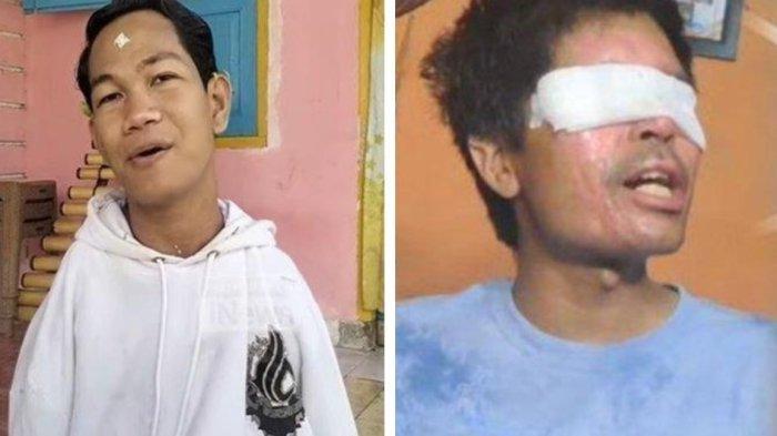 Nama Agus Menjadi Topik Viral, Kasus Agus Salim dengan Agus Buntung ...