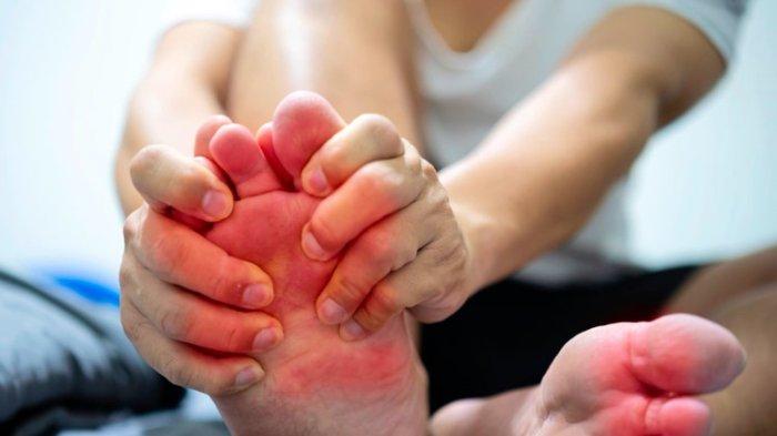 Penyebab, Bahaya dan Cara Obati Asam Urat, Jangan Abaikan Bisa Tidak ...