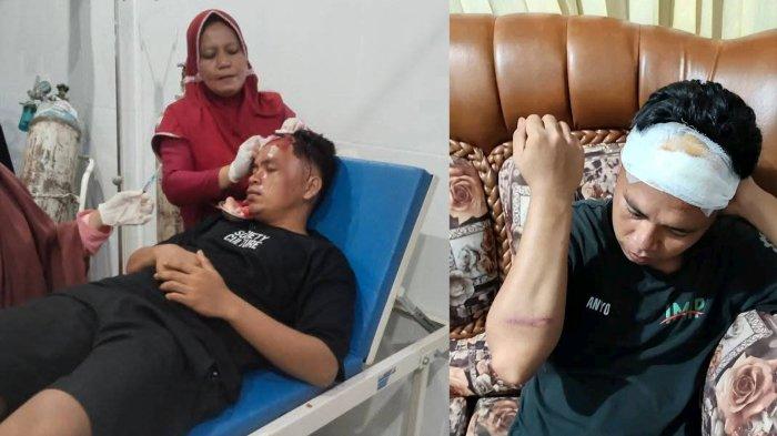 WARGA DIPUKUL POLISI - Kondisi Ismail Anyo pasca mendapat pukulan dengan pentungan dari oknum polisi Gorontalo Utara. Kejadiannya pada Minggu (11/5/2025).