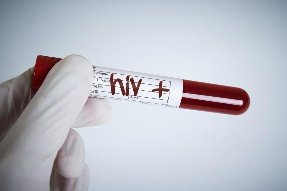 ilustrasi positif terpapar penyakit HIV