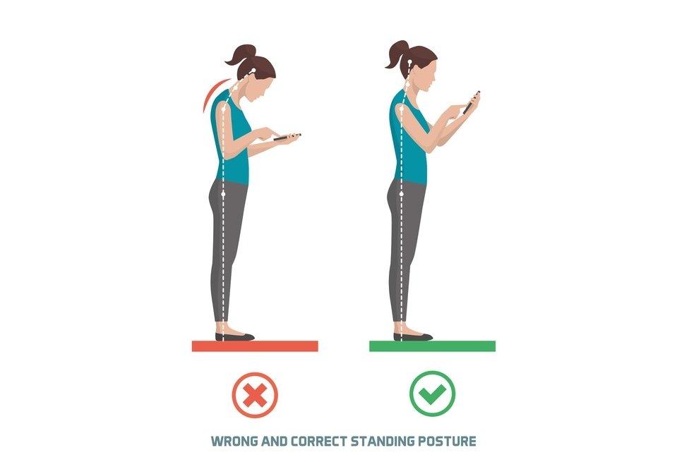 Text neck syndrome