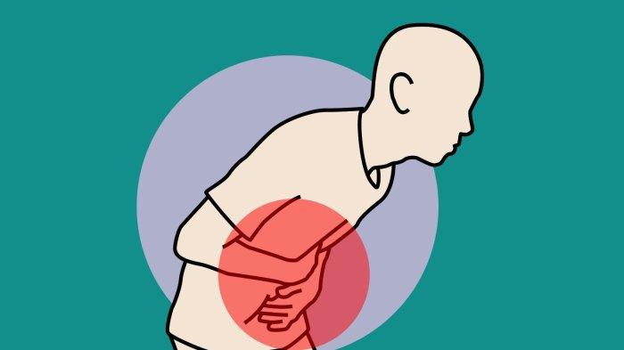 ilustrasi seseorang yang mengalami asam lambung
