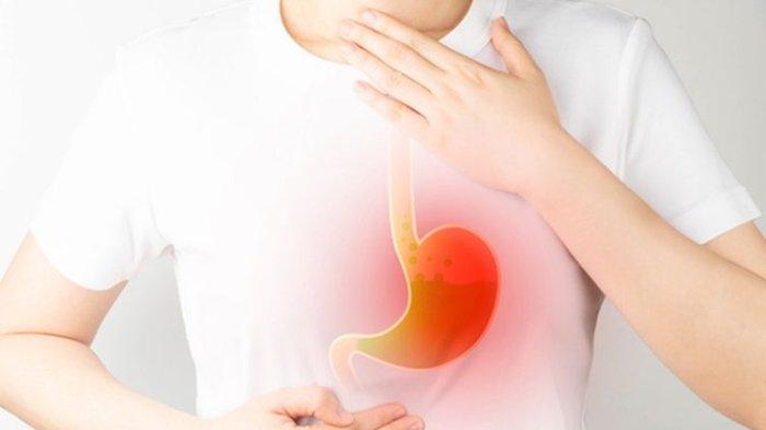 ilustrasi seseorang yang mengalami asam lambung