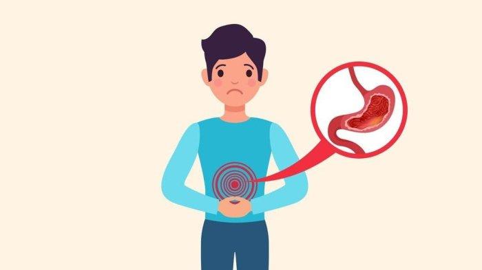 ilustrasi seseorang yang mengalami kanker lambung