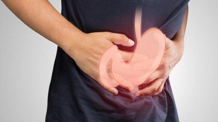 ilustrasi seseorang yang mengalami asam lambung, berikut tips puasa sehat bagi penderita asam lambung