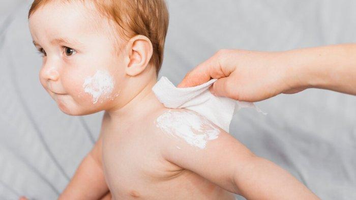 Ilustrasi bayi yang alami biang keringat