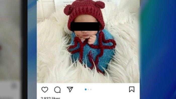 Bayi prematur meninggal setelah dijadikan konten