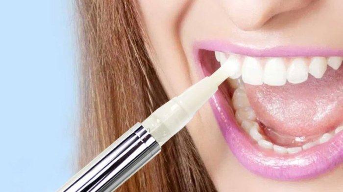 ilustrasi bleaching gigi, begini kata Dokter Gigi, drg. R. Ngt. Anastasia Ririen Pramudyawati