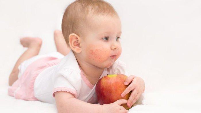 ilustrasi bayi yang mengalami iritasi kulit, berikut ini faktor yang memengaruhi kesehatan kulit bayi