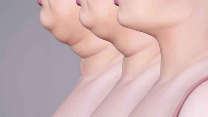ilustrasi memiliki double chin