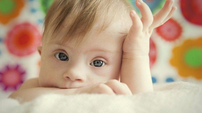 ilustrasi anak down syndrome