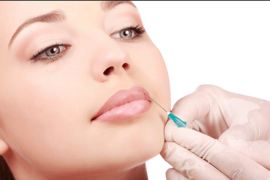 ilustrasi filler treatment