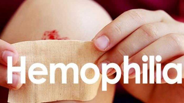 ilustrasi penderita hemofilia