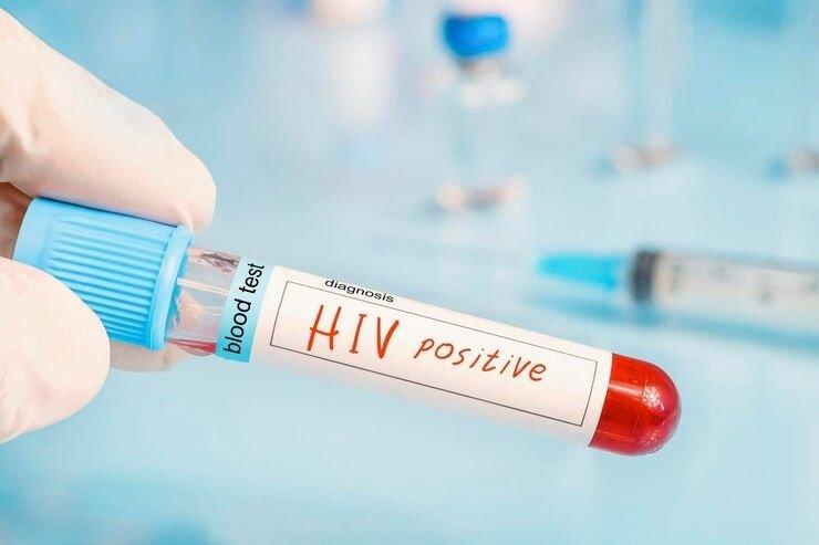 ilustrasi positif HIV