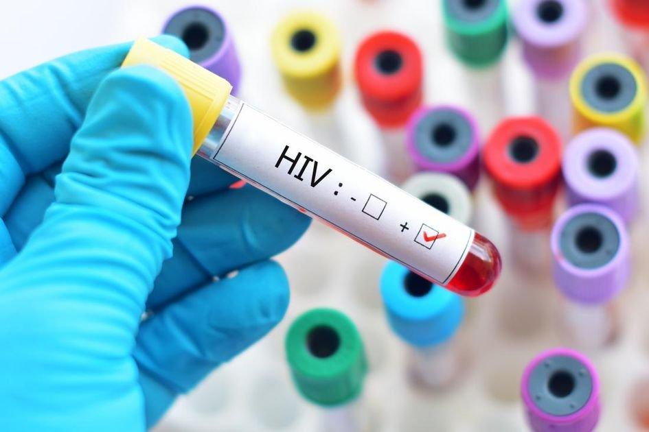 ilustrasi positif mengalami HIV