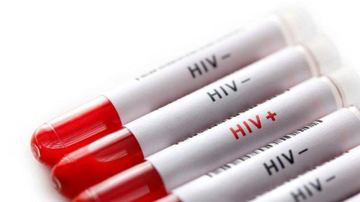 ilustrasi test penyakit hiv