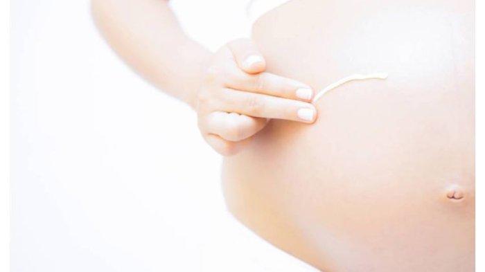 Ilustrasi munculnya stretch mark pada ibu hamil