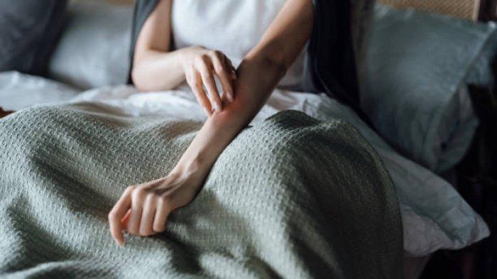 Ilustrasi alergi kulit menimbulkan gatal