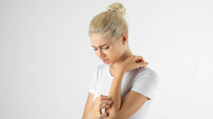 Ilustrasi alergi kulit yang mengganggu