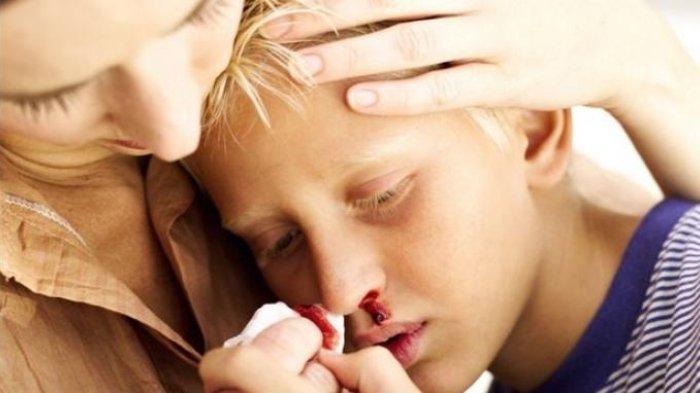 Ilustrasi anak mimisan