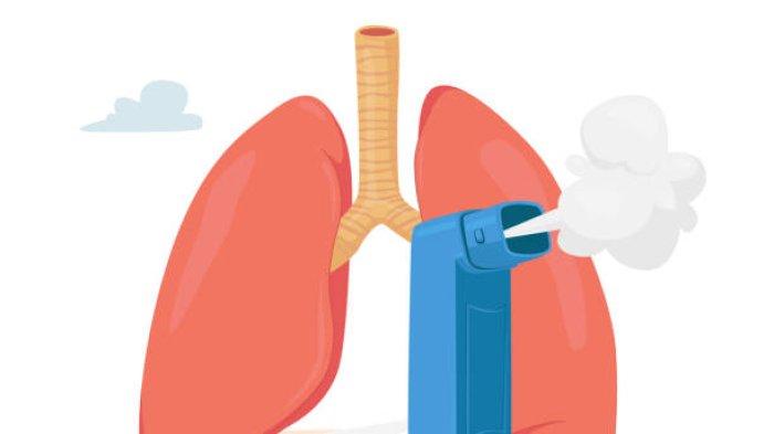 Ilustrasi dampak fatal penderita asma terpapar polusi