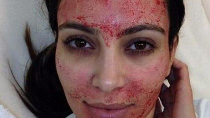 Ilustrasi facial vampire