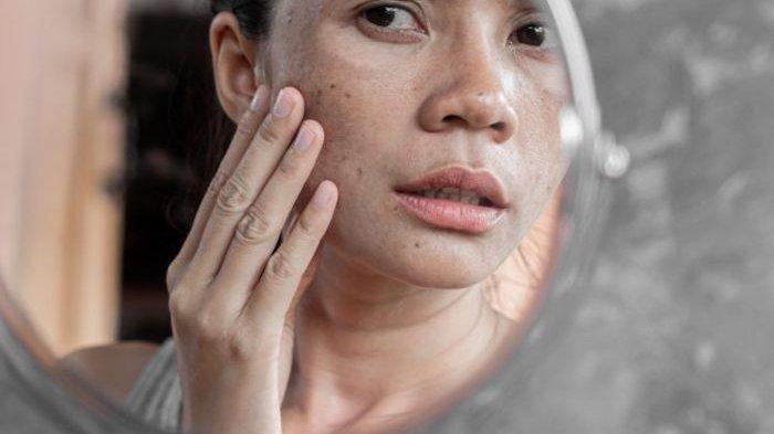 Ilustrasi masalah flek hitam pada ibu hamil, berikut cara mengatasinya