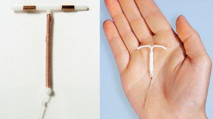 Ilustrasi IUD