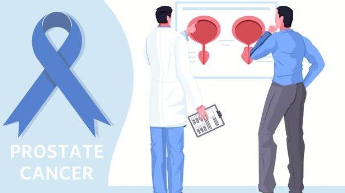 Ilustrasi kanker prostat