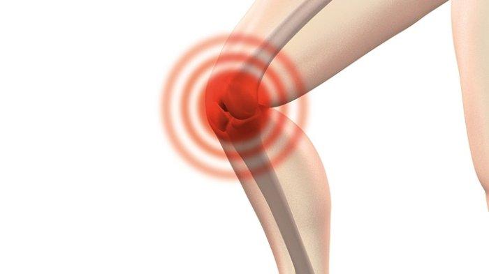 Ilustrasi osteoarthritis