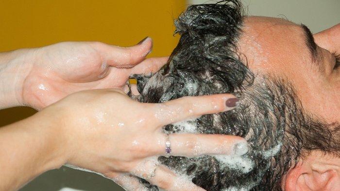 Ilustrasi keramas untuk mengatasi masalah ketombe, berikut penjelasan Dokter Spesialis Kulit dan Kelamin mengenai ketombe