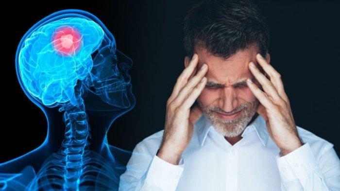 Ilustrasi penderita tumor otak