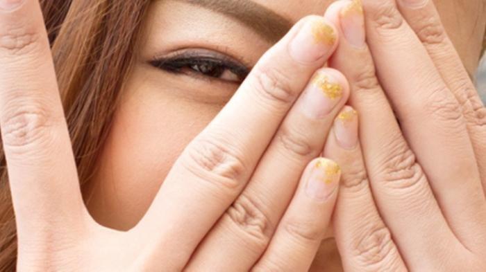 Ilustrasi perempuan tidak boleh berganti-ganti pasangan agar terhidar dari penyakit seksual menular