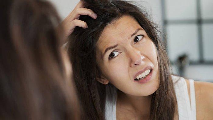 Ilustrasi seseorang yang mengalami dermatitis seboroik, berikut penjelasan Dokter Spesialis Kulit dan Kelamin mengenai dermatitis seboroik