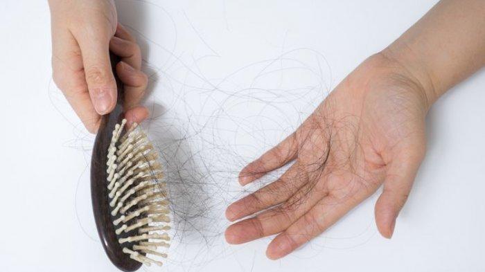 Ilustrasi seseorang yang mengalami rambut rontok, berikut nutrisi yang bagus untuk kesehatan rambut