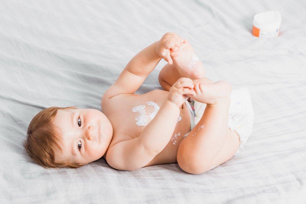 ilustrasi penggunaan lotion bayi untuk mengatasi iritasi kulit