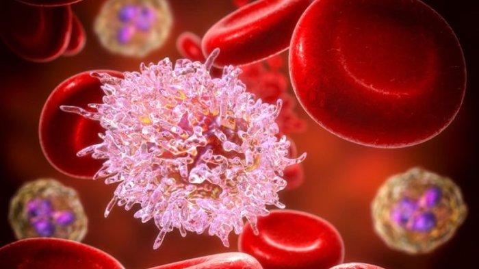 ilustrasi kanker darah