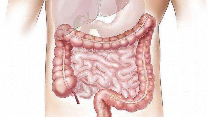 ilustrasi menjaga kesehatan usus