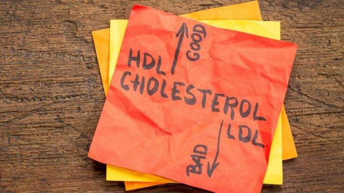 ilustrasi kolesterol tinggi, berikut makanan yang dapat menurunkan kadar kolesterol