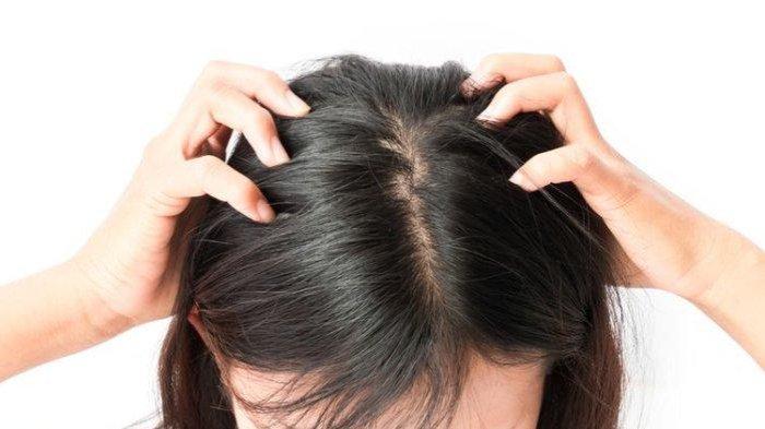 Ilustrasi seseorang yang memiliki kutu rambut