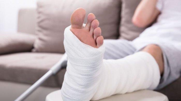 llustrasi patah tulang